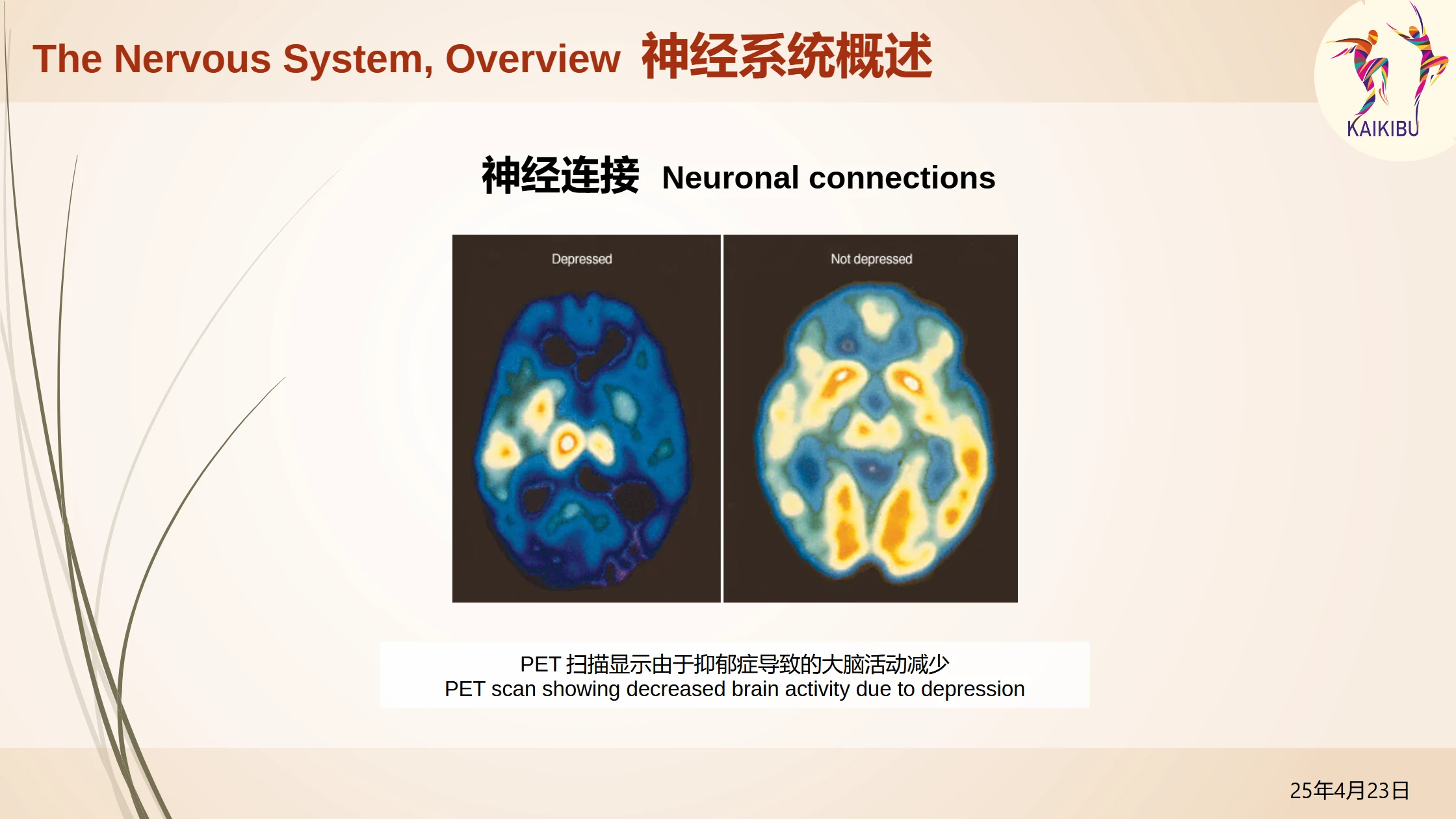 TALK_Neuro-Anatomy of Movement_p7